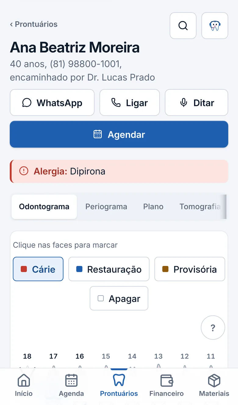Kanal no celular: o prontuário da paciente, com os botões WhatsApp, Ligar, Ditar e Agendar, o alerta de alergia, as abas Odontograma, Periograma, Plano e Tomografia e o odontograma.
